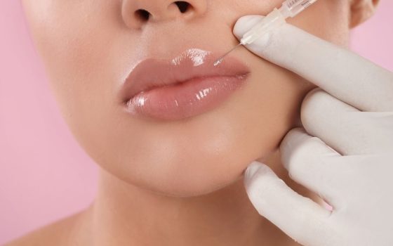 lip filler issues